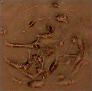 Neurons forming a network in disassociated cell culture. Neurons forming a network in disassociated cell culture.