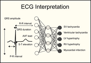 A diagram showing how to interpret the results of an ECG. A diagram showing how to interpret the results of an ECG.